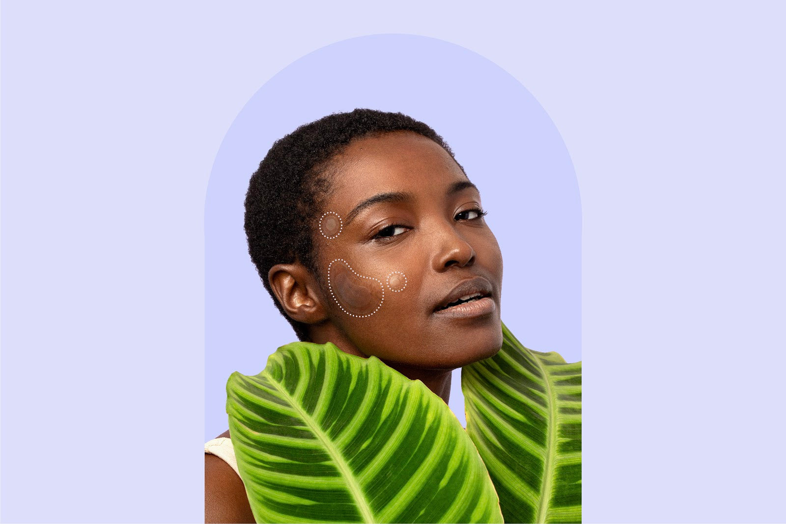 Acne Stickers: How They Work and Are They Effective? – Rael