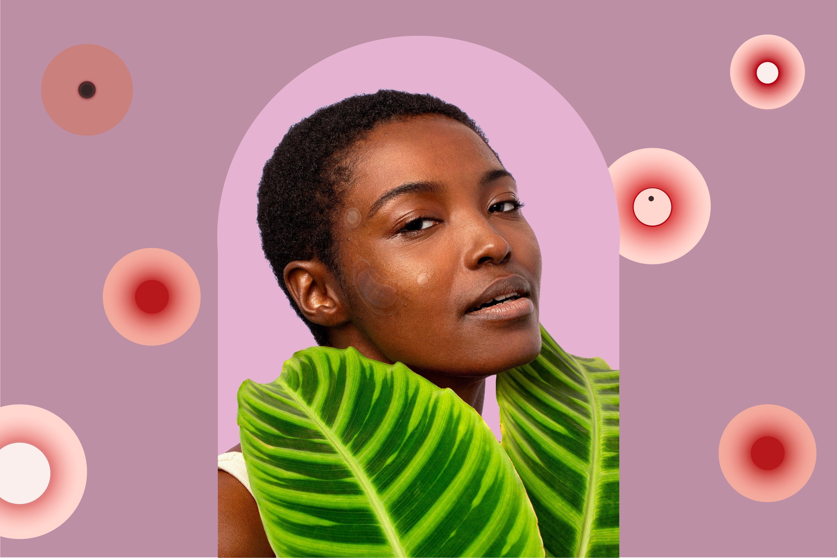 6 Ways to celebrate acne awareness month - model with pimple patches.