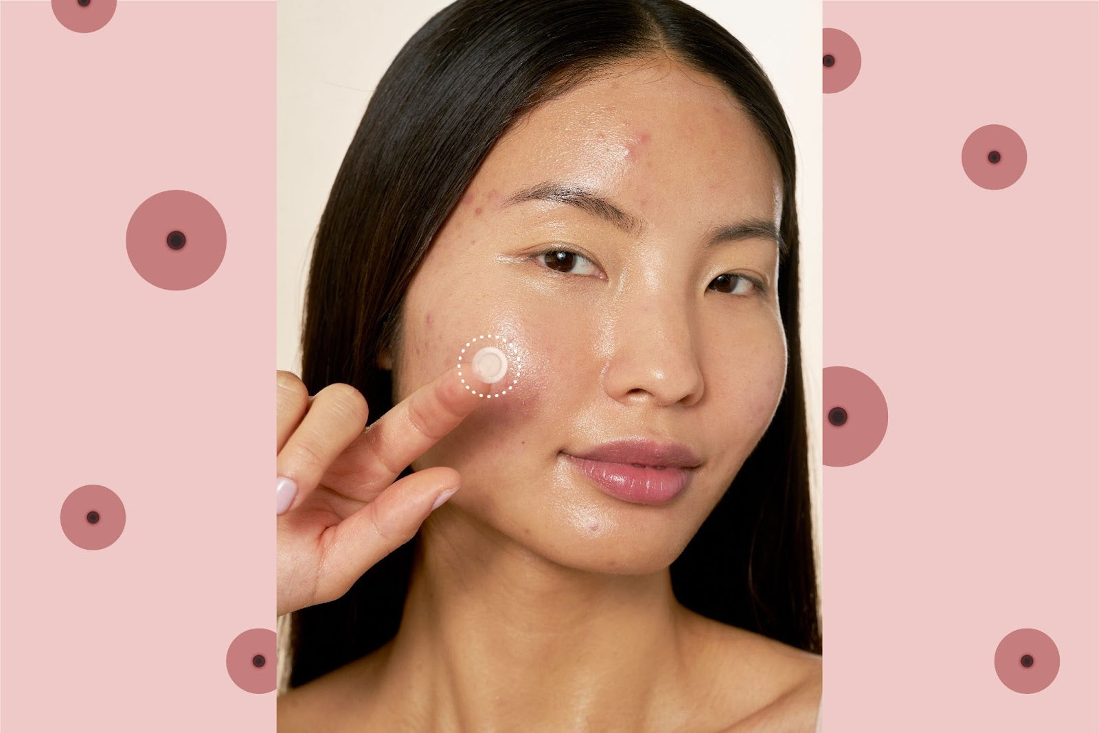 Smiling woman pointing to a blackhead on her face against a pink background.