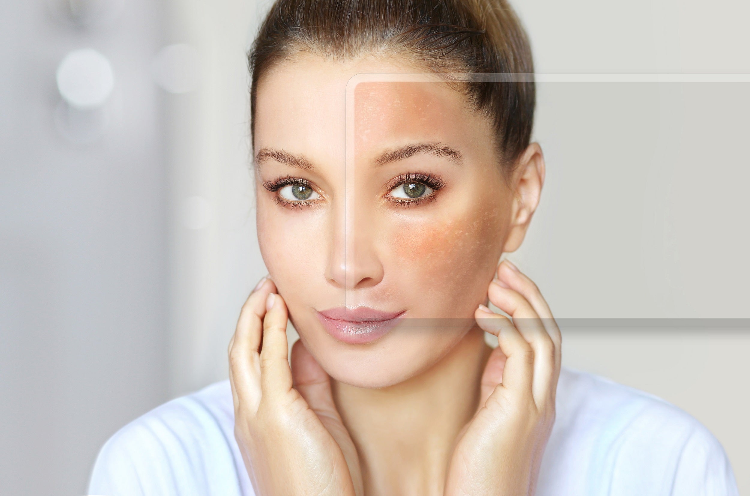 Woman with visibly damaged skin barrier
