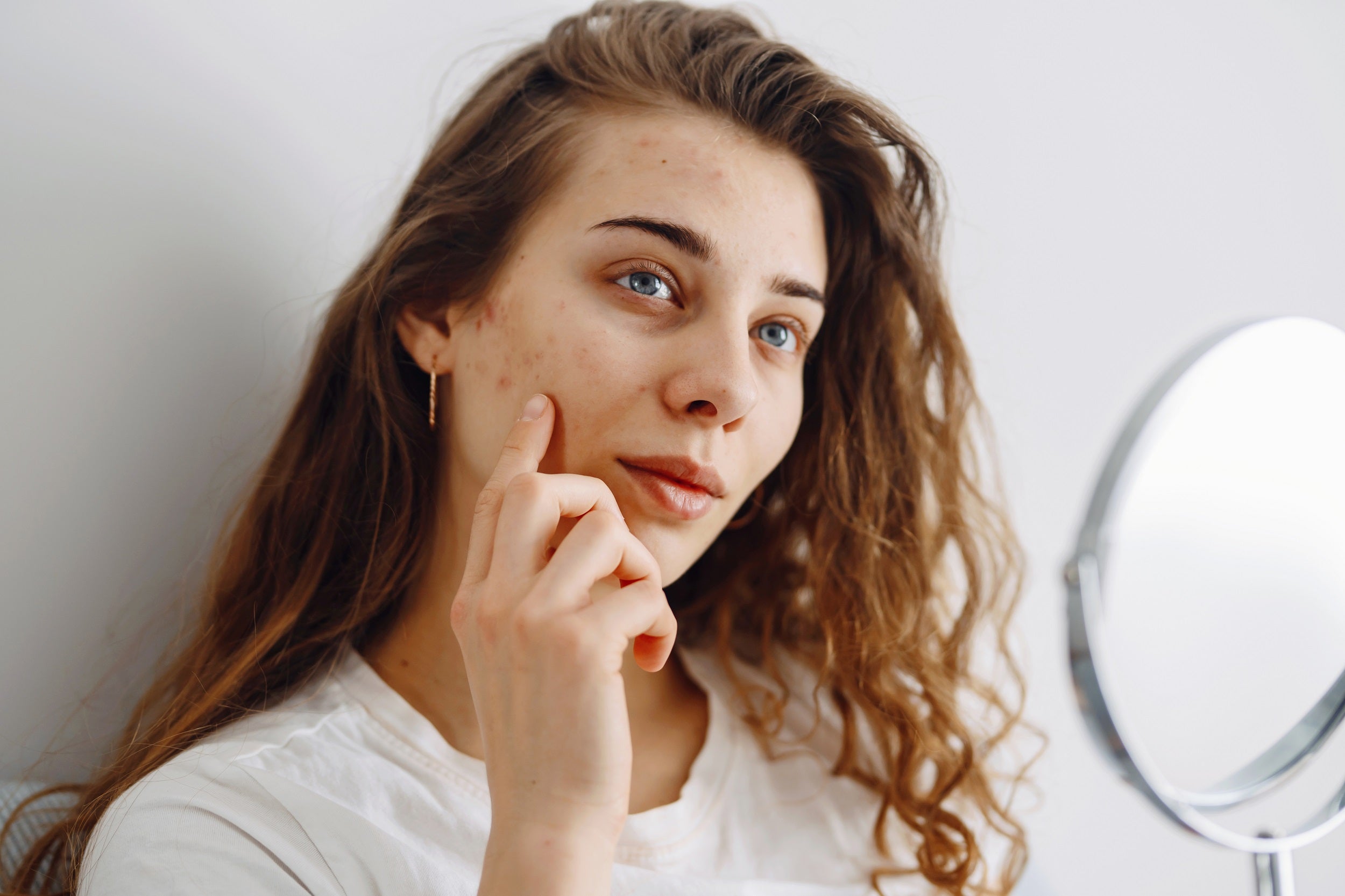 Spots That Keep Coming Back