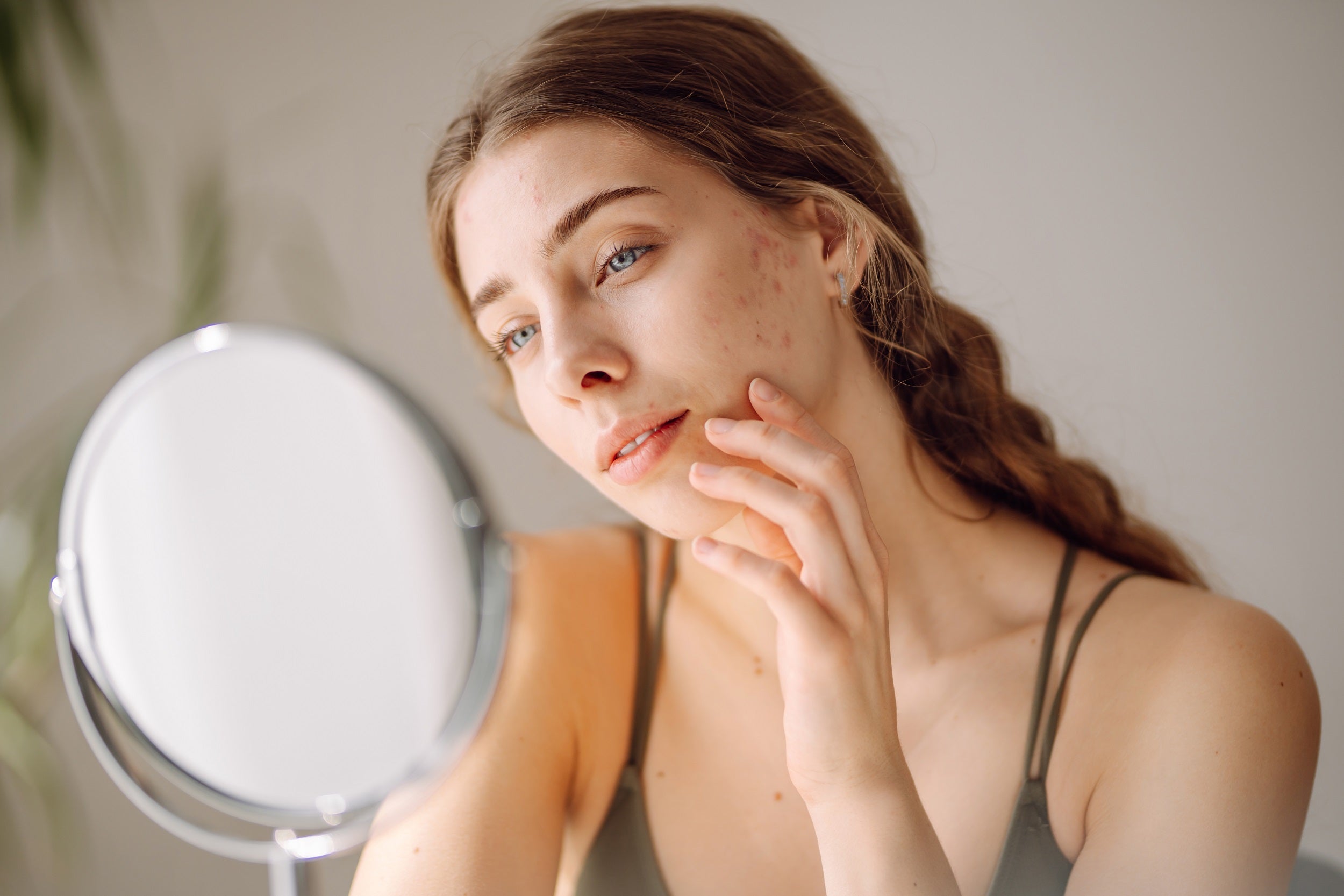 Skincare Tips for Blemish-Prone Skin