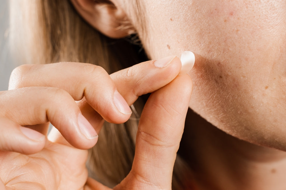 Do pimple patches work on cysts? Find answers and insights in this informative guide on managing stubborn blemishes.