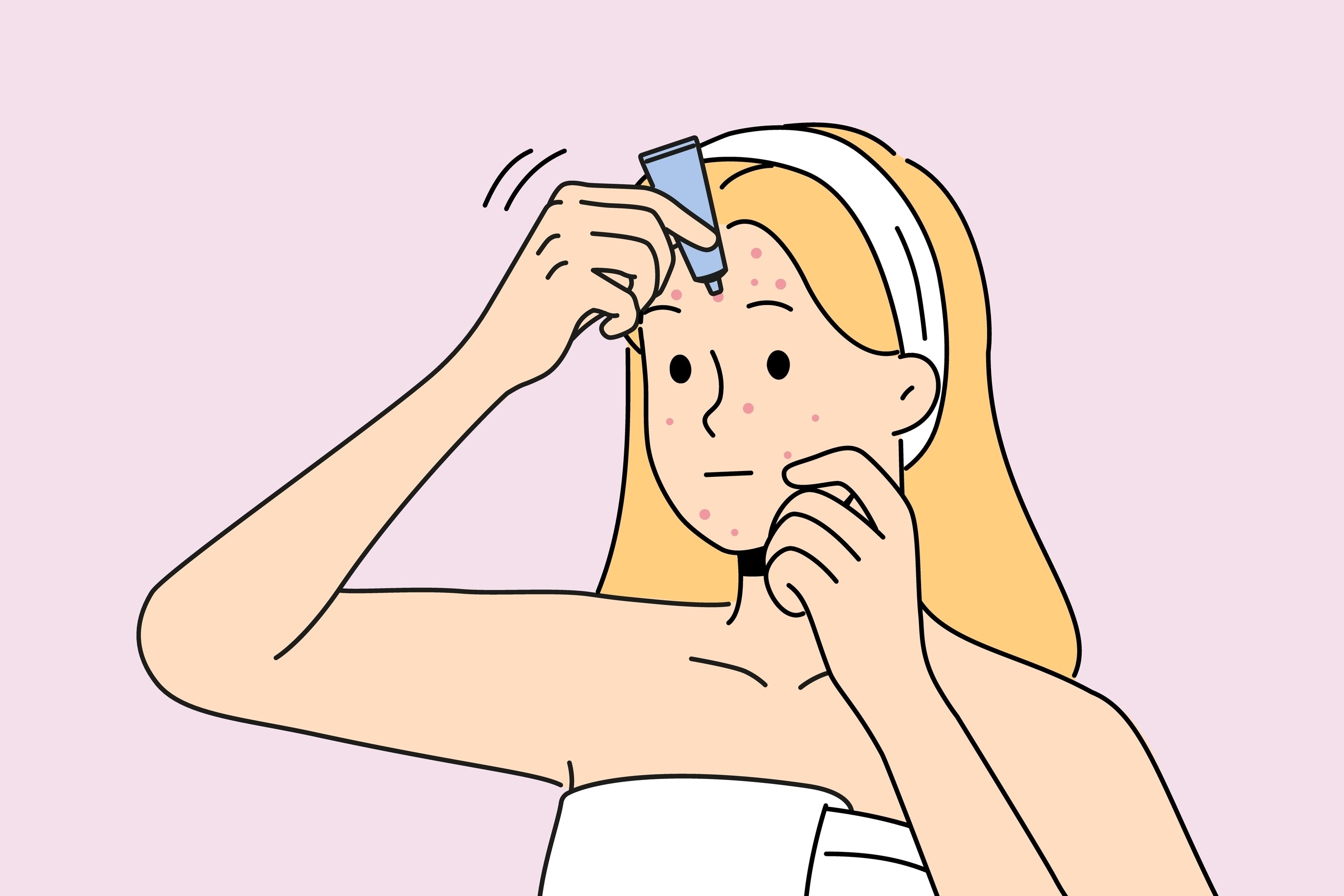Nodule vs. Cystic Pimple: Key Differences