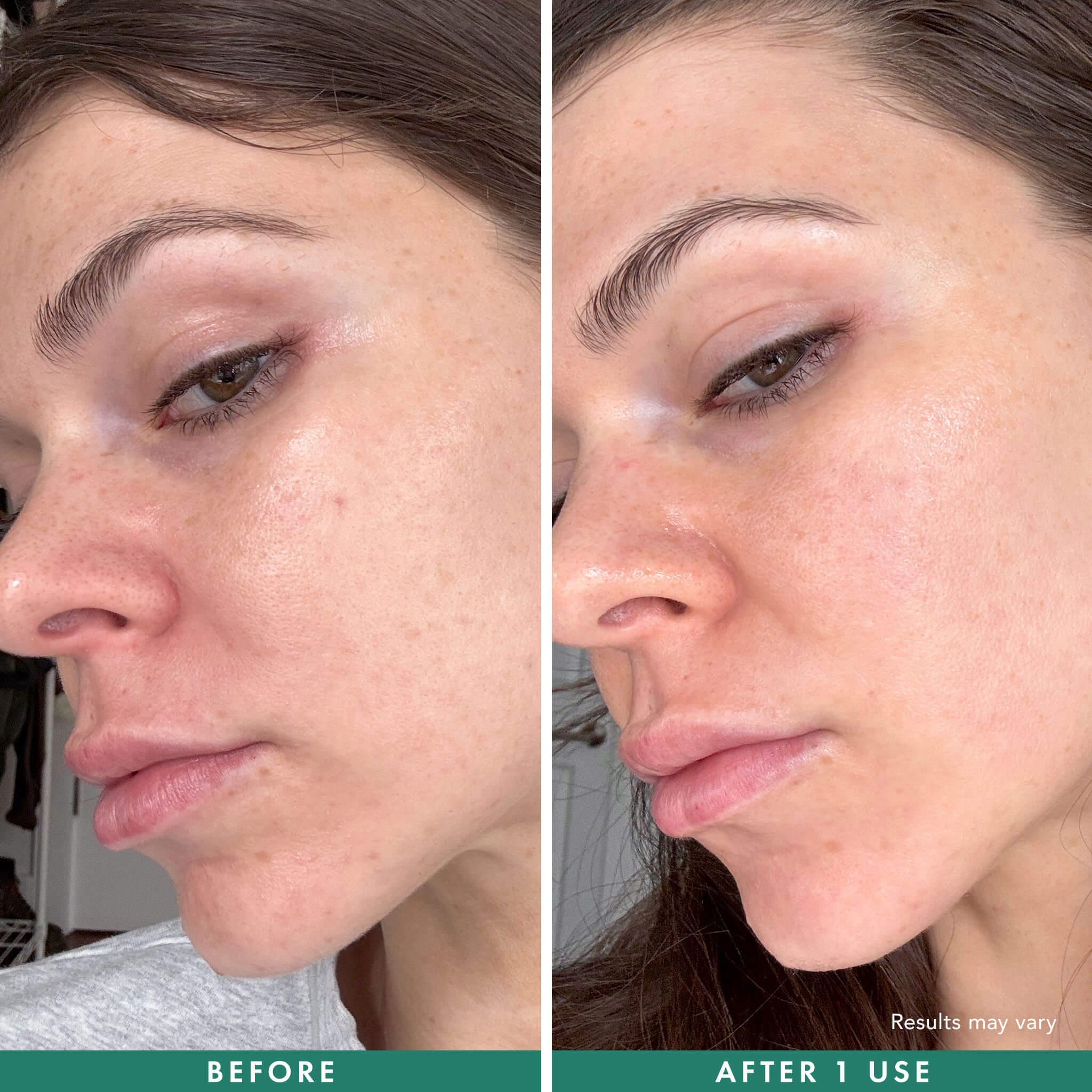Before-and-after close-up comparison of a woman's face showing skin improvement, with text labels 'BEFORE' and 'AFTER 1 USE' on a teal banner at the bottom.