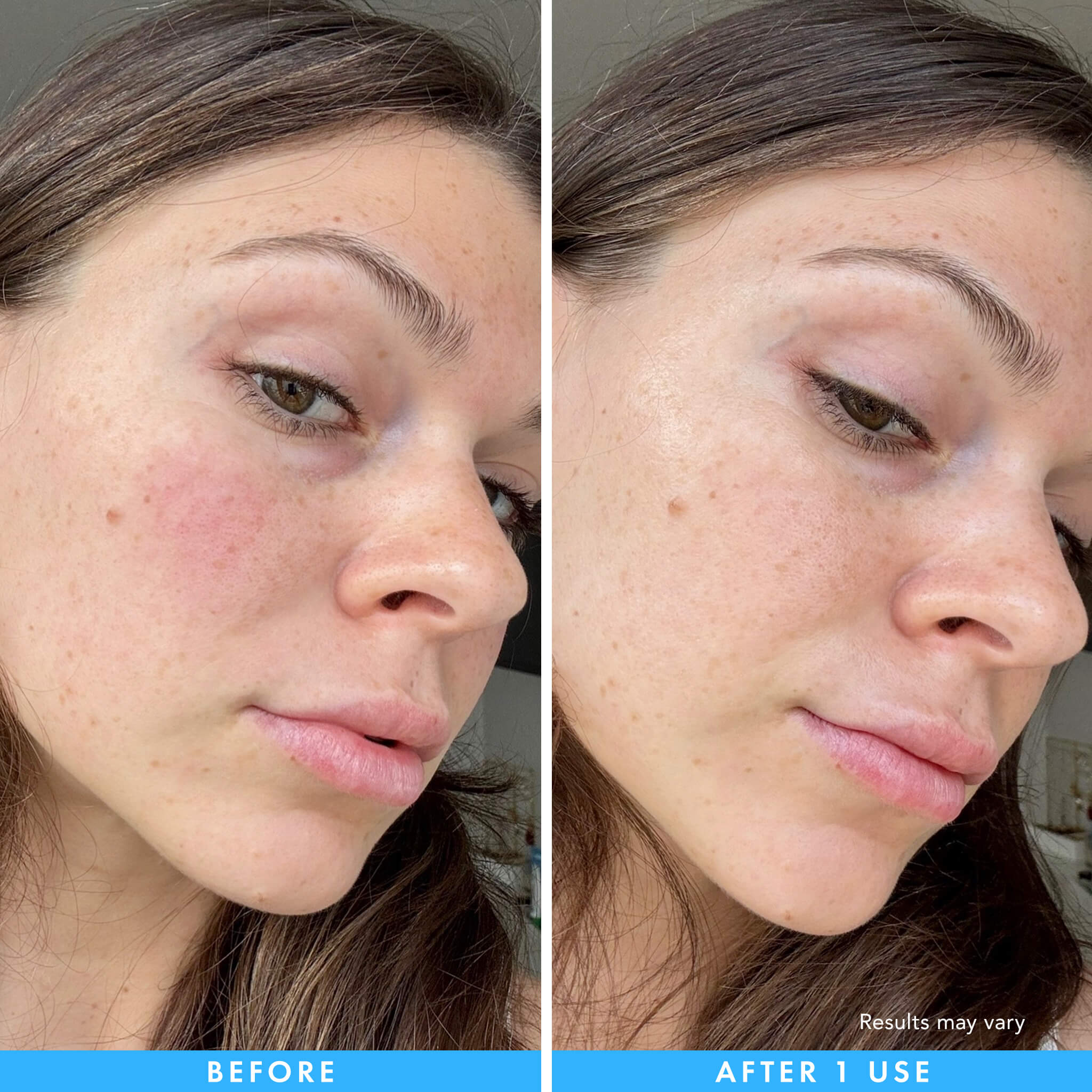 Before and after comparison of a woman's face with visible redness, showing a reduction in redness, after 1 use.