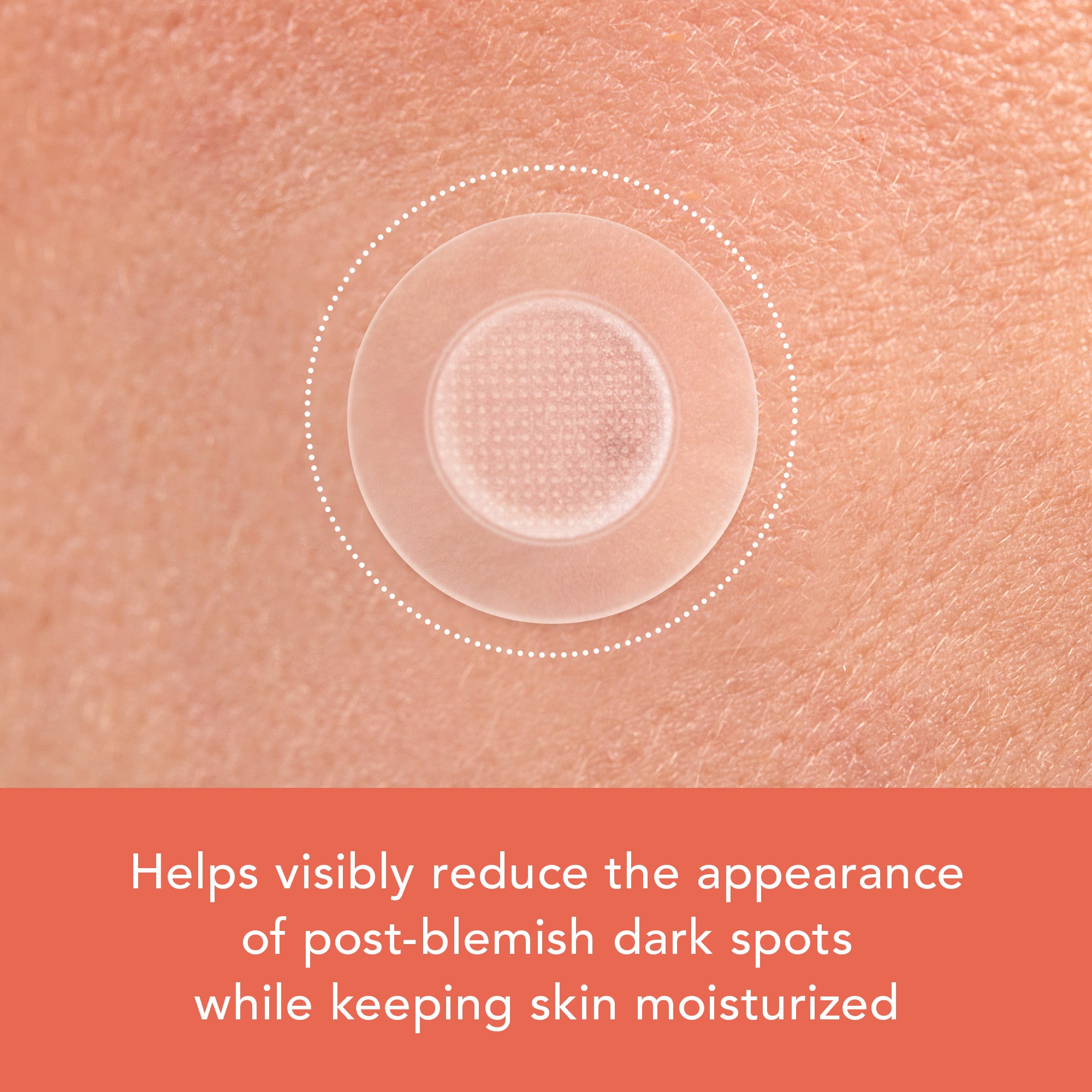 Close-up of skin with a dark spot, showing product application, on a peach background with text about reducing post-blemish dark spots.