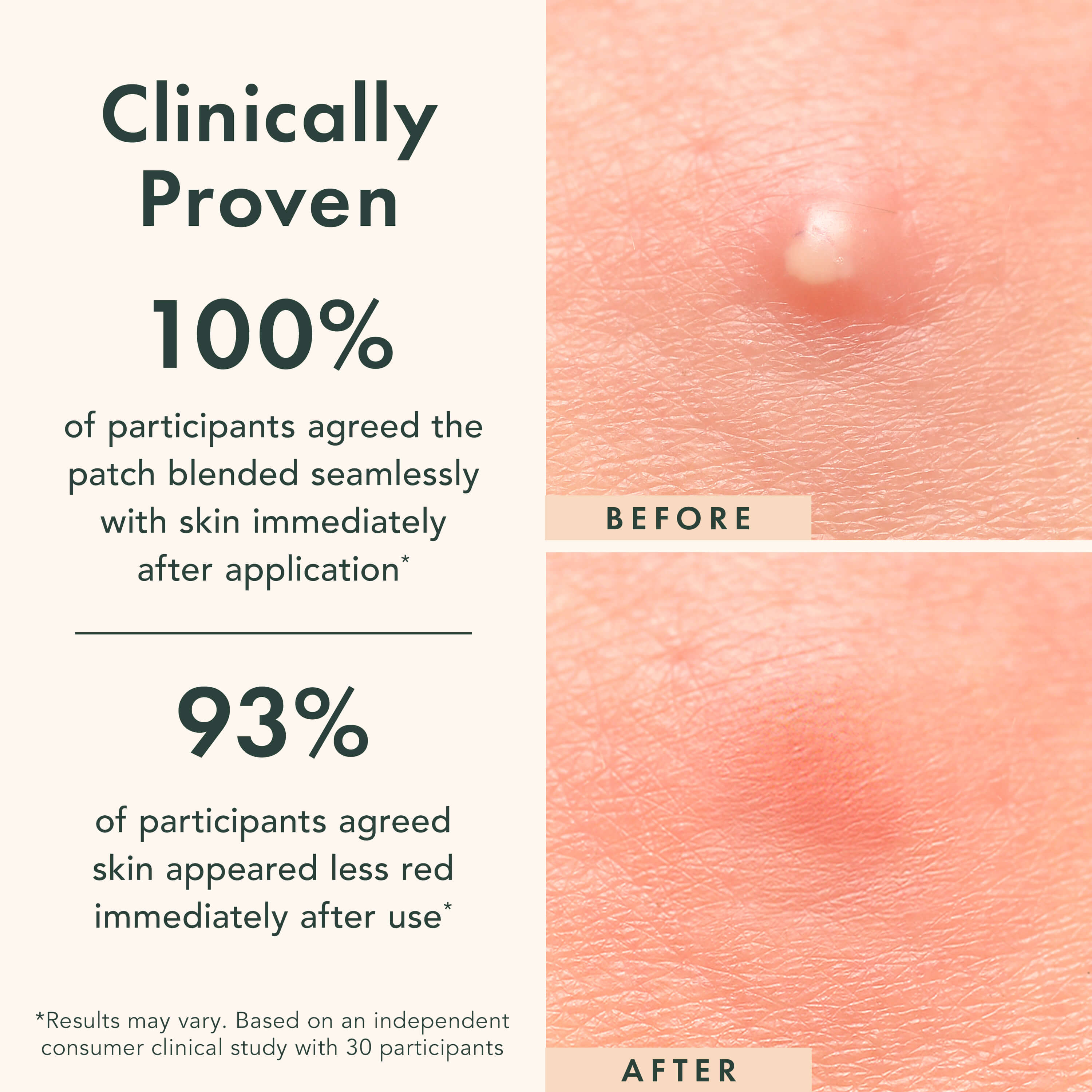 Before and after skin patch application with clinical study results on a white background