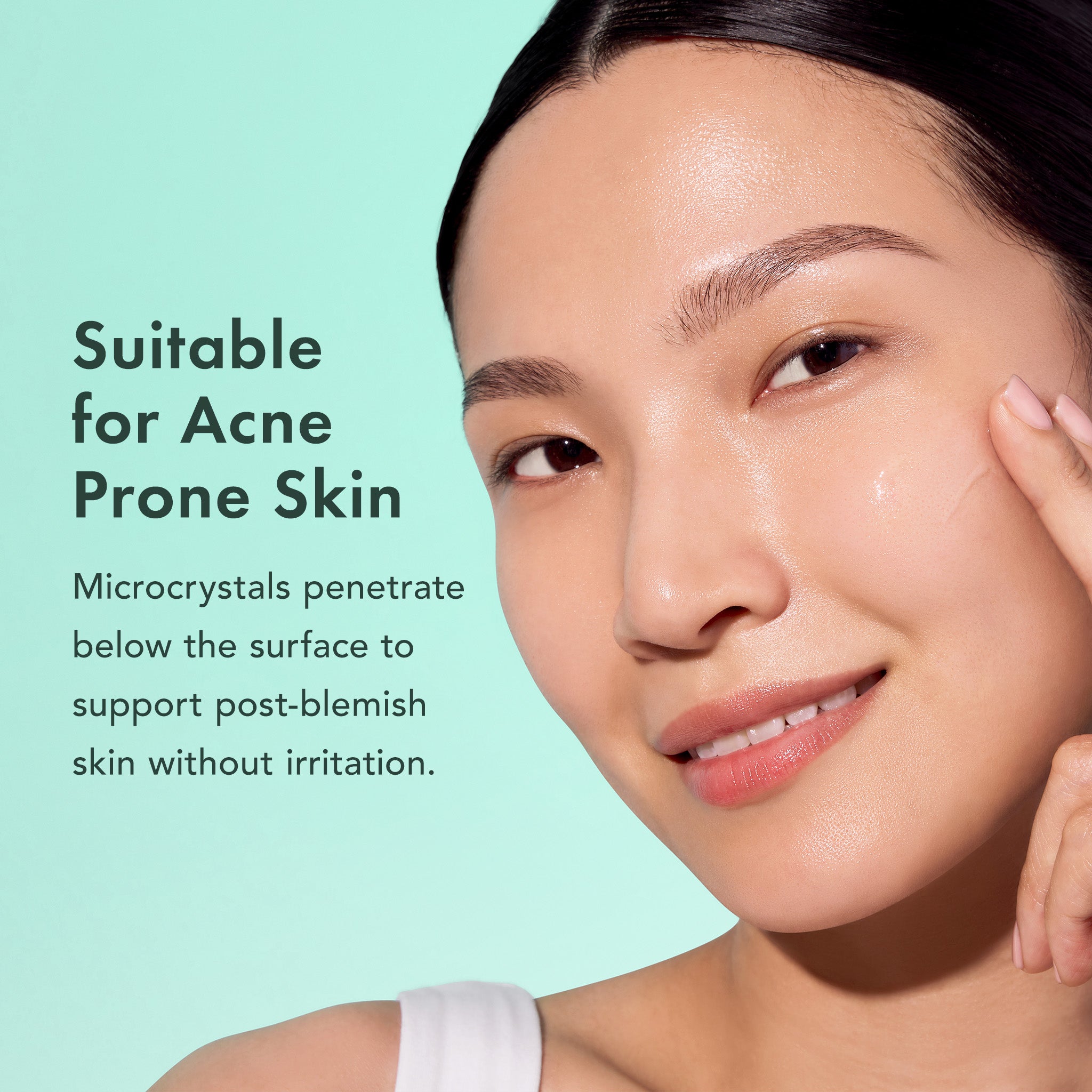 Woman with acne-prone skin on a teal background with text about microcrystals.