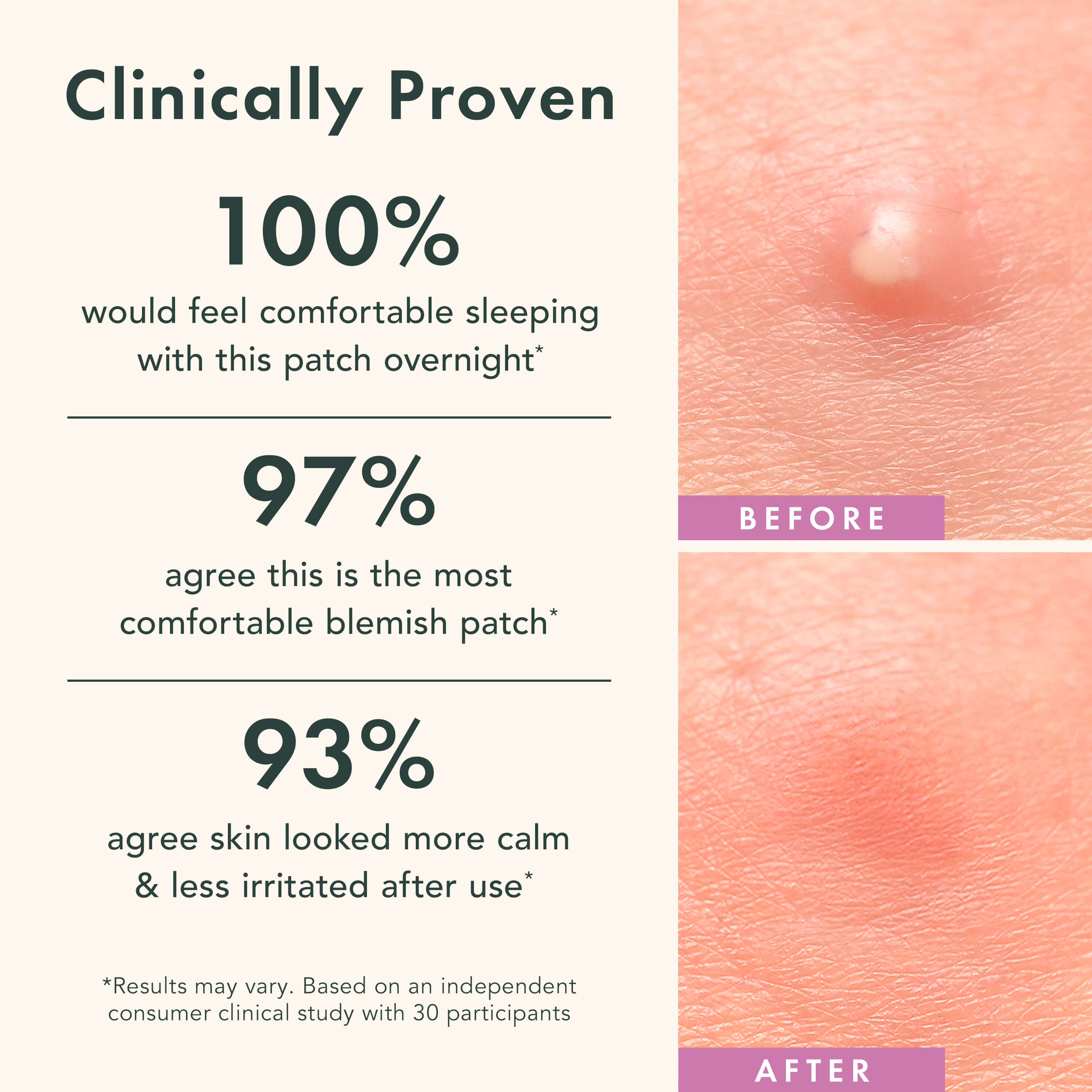 Before and after effect of a blemish patch with clinical proven statistics on a white background.