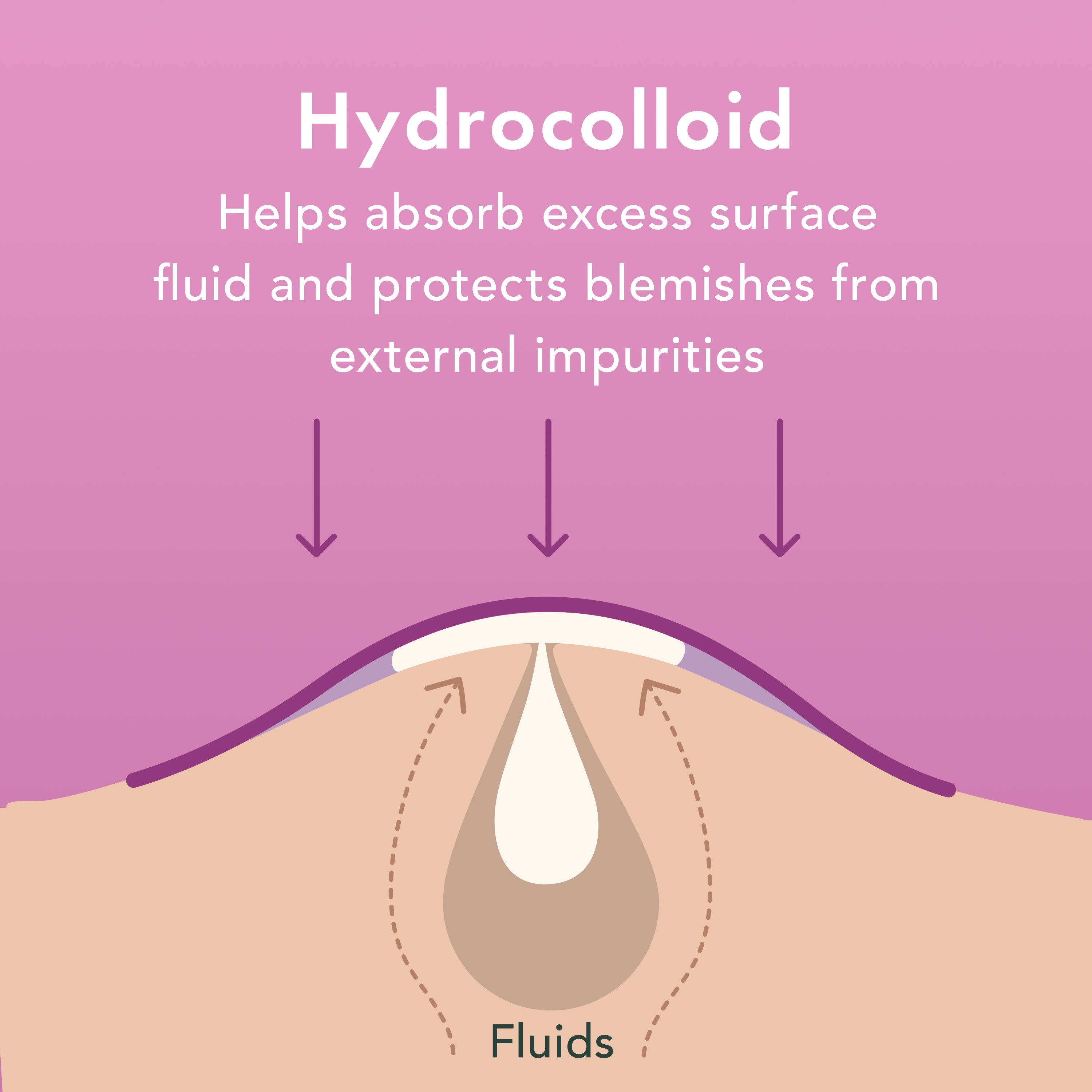 Illustration of hydrocolloid dressing on skin with text explaining its function.