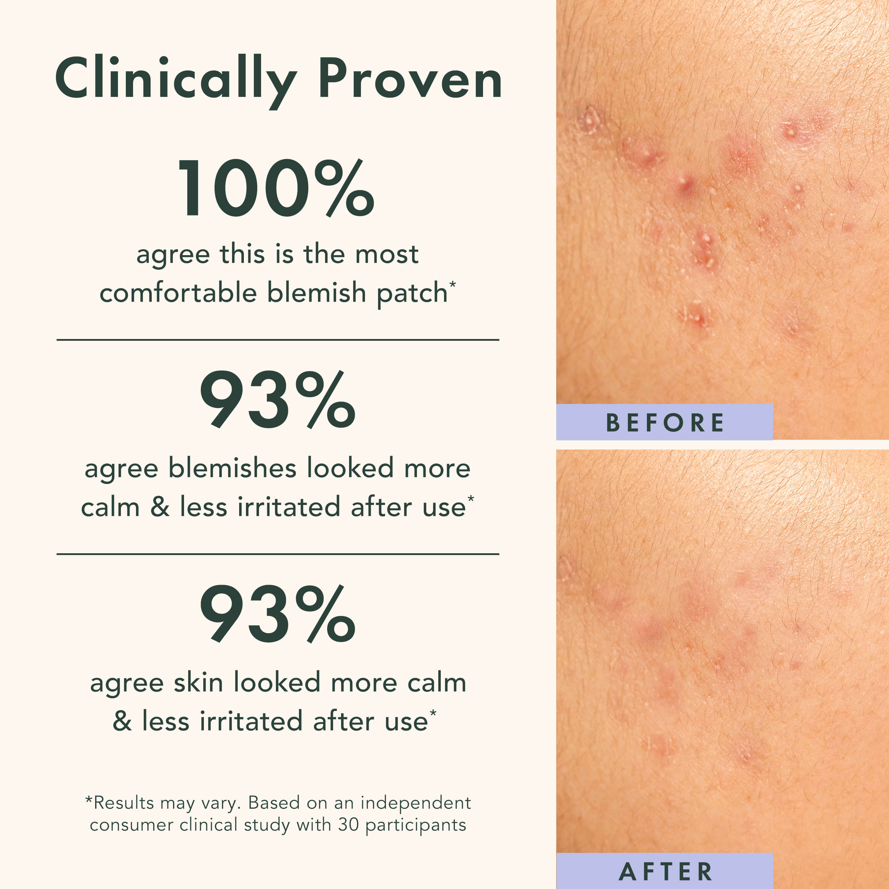 Before and after effect of a blemish patch on skin with clinical statistics displayed.
